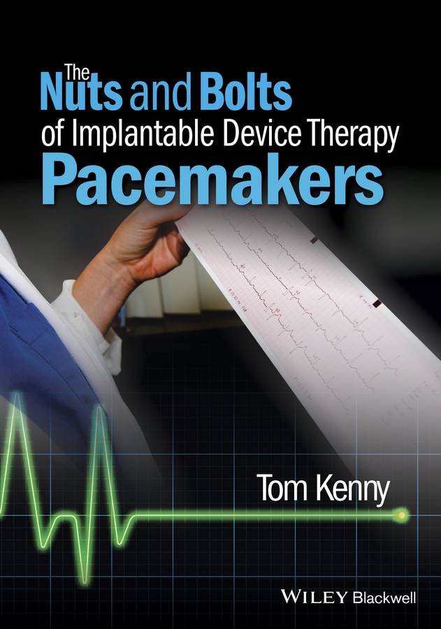 The Nuts and Bolts of Implantable Device Therapy. Pacemakers