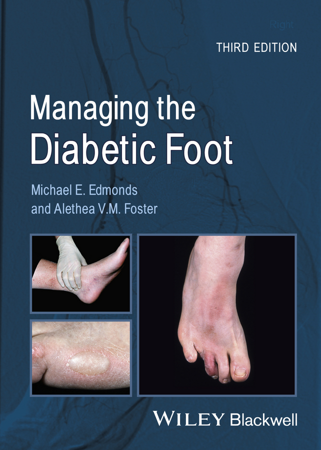 Foster Alethea V.M. Managing the Diabetic Foot