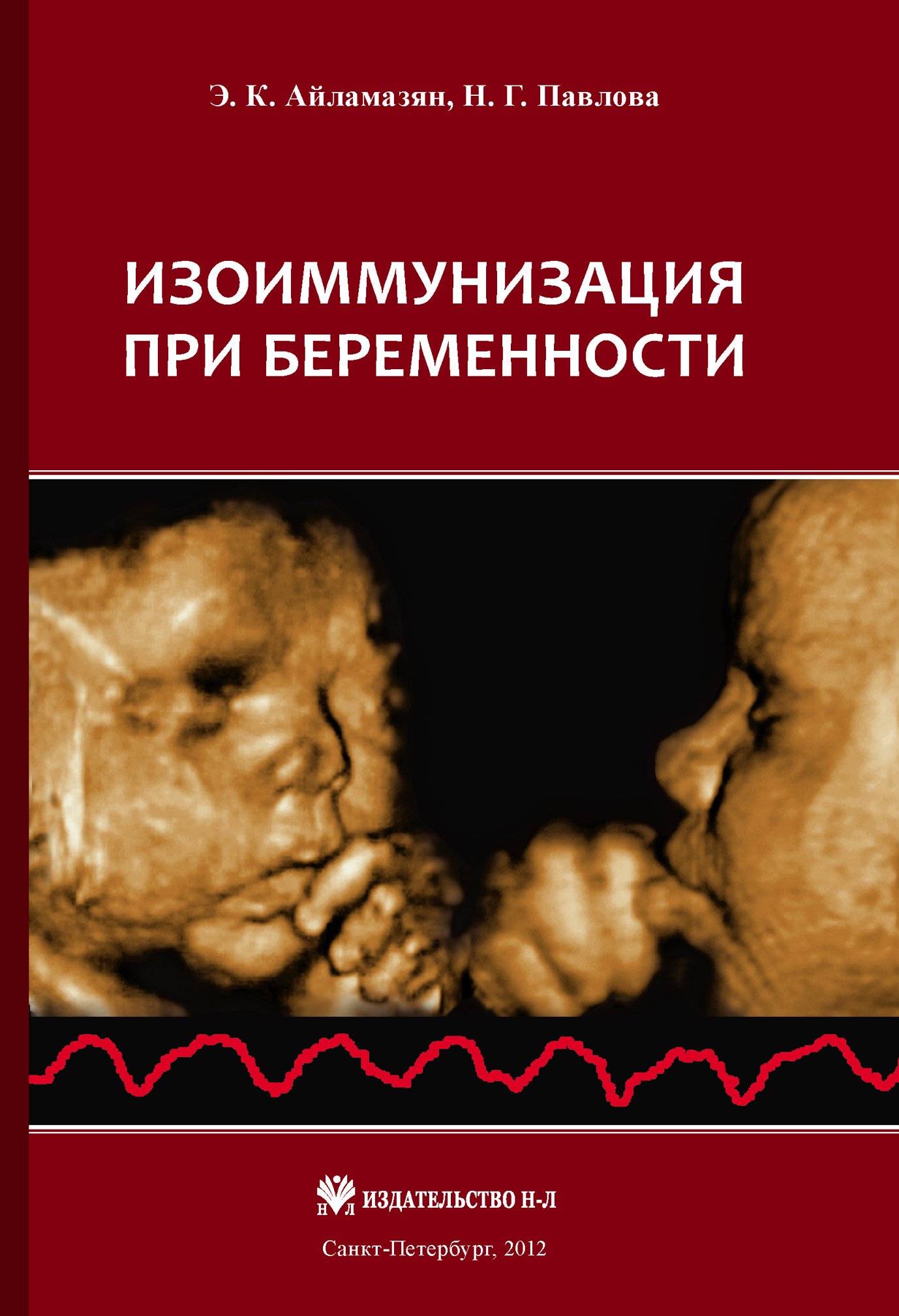 Э. К. Айламазян Изоиммунизация при беременности