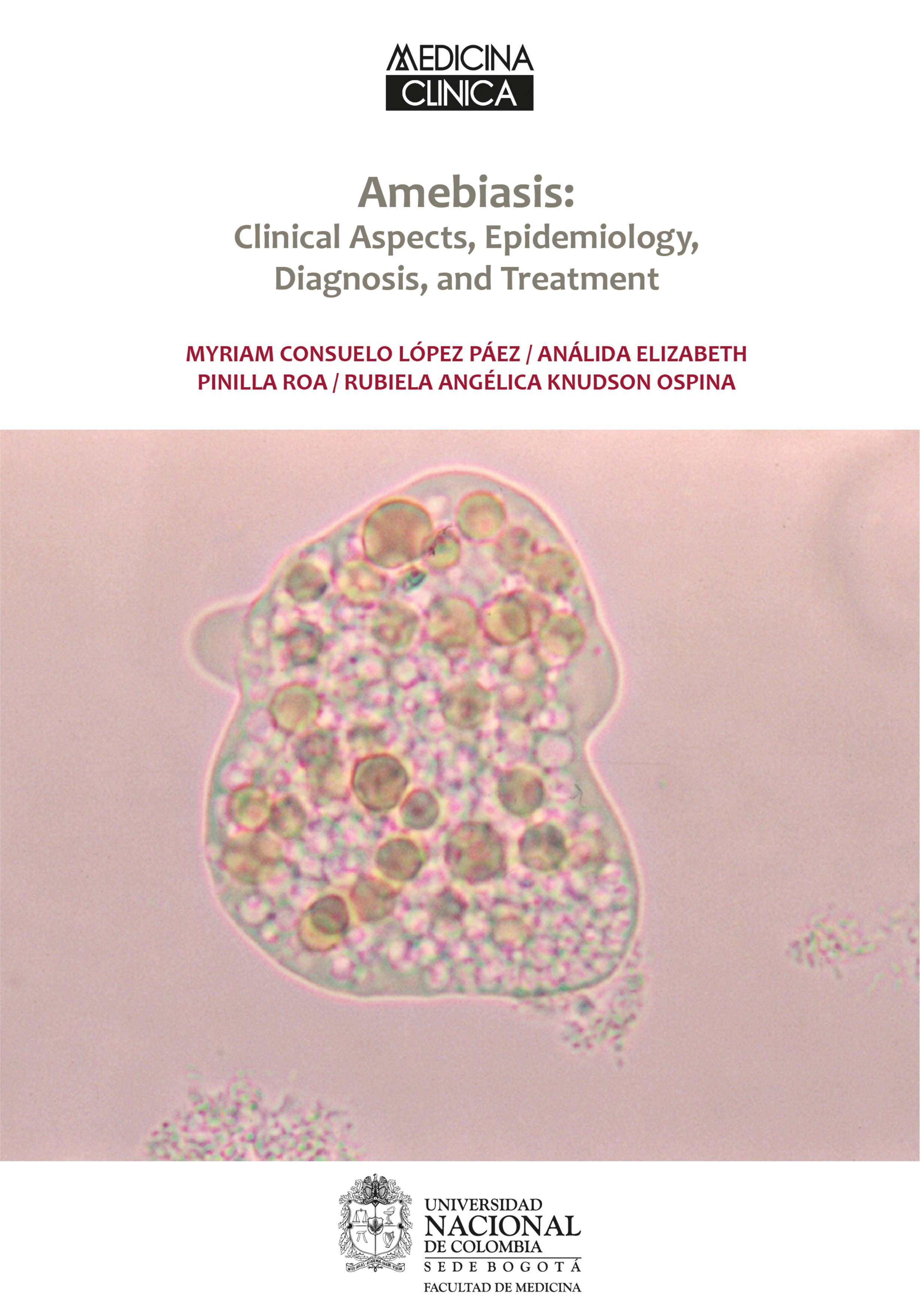 

Amebiasis: Clinical Aspects, Epidemiology, Diagnosis, and Treatment