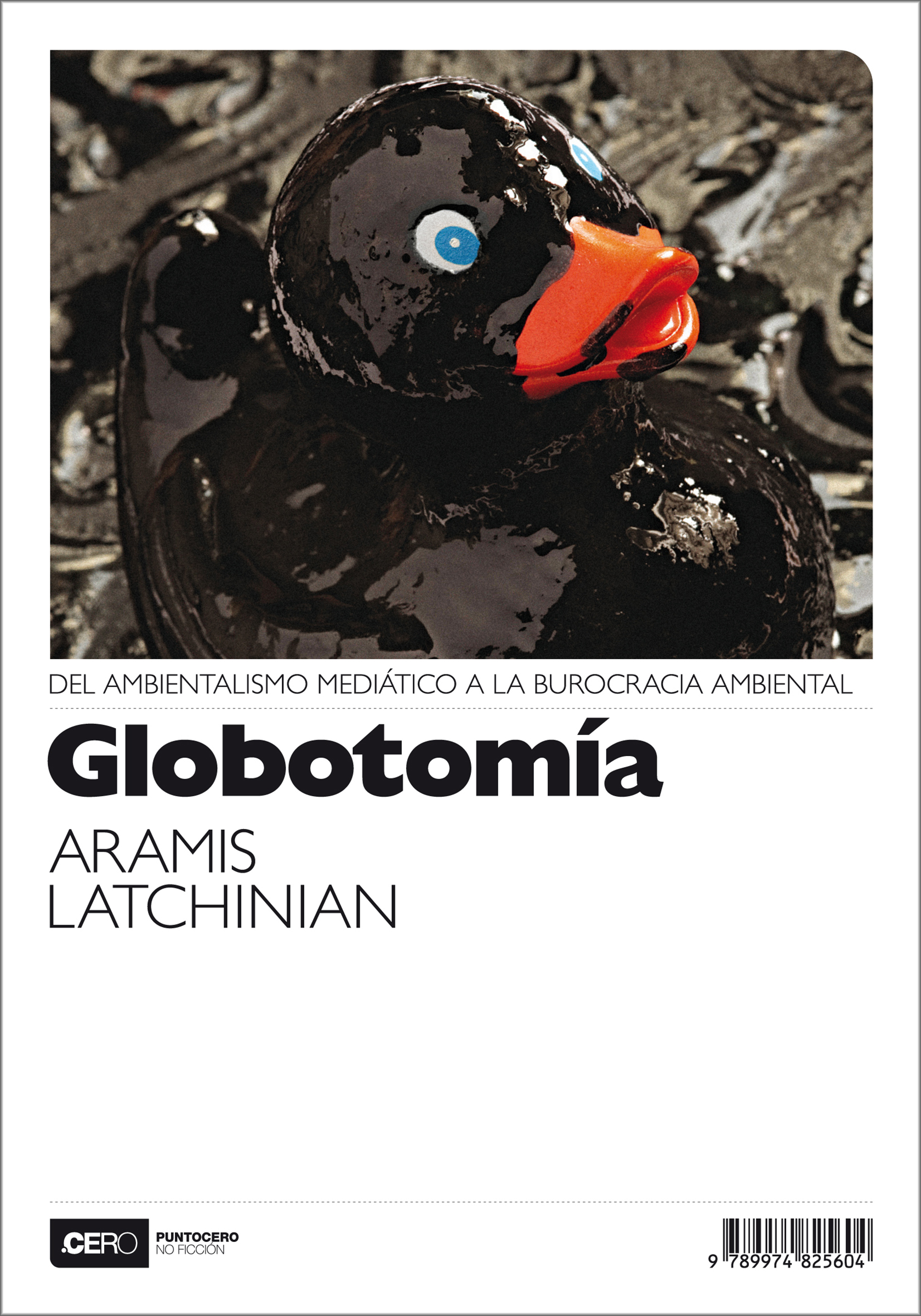 Globotomía