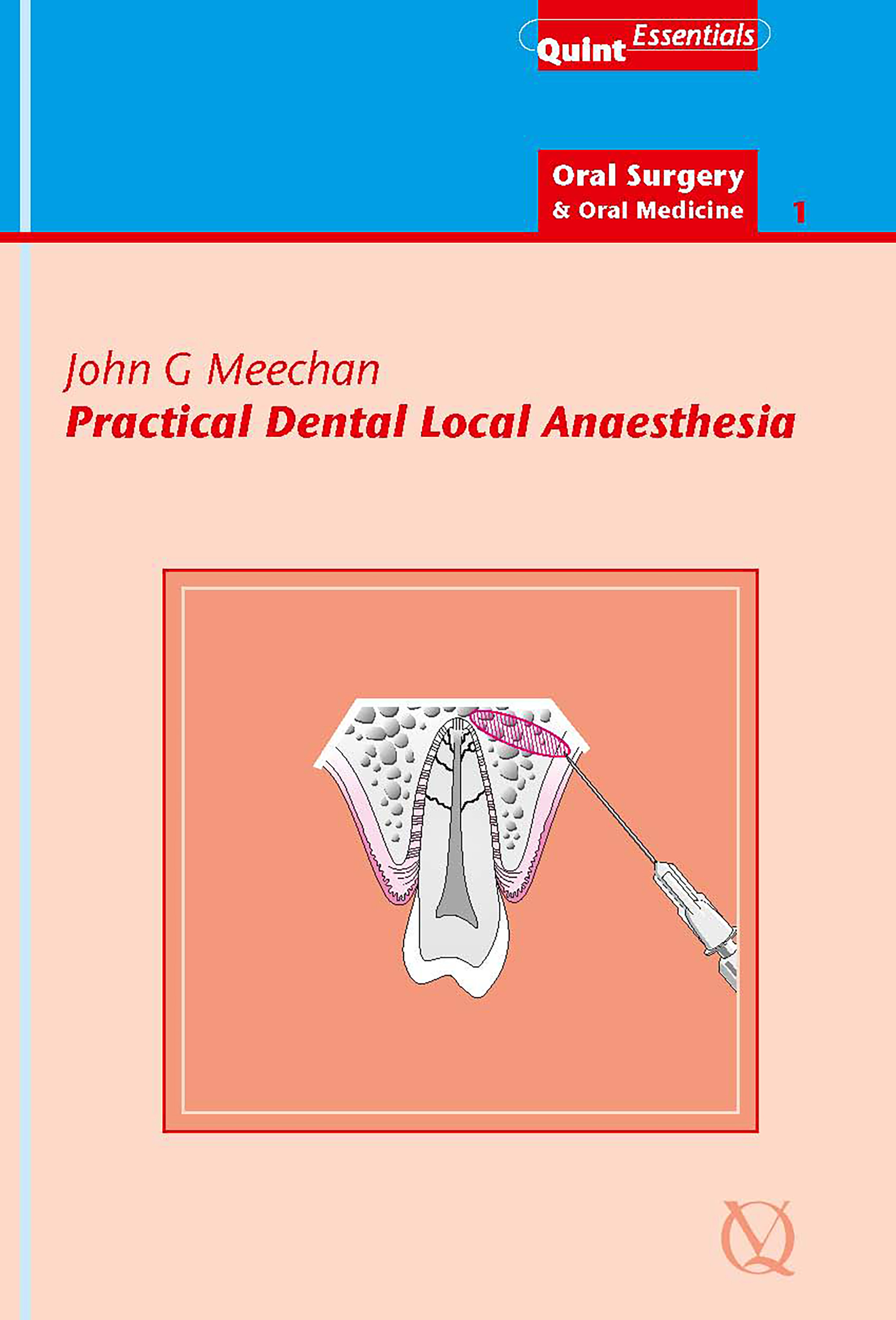 Practical Dental Local Anaesthesia