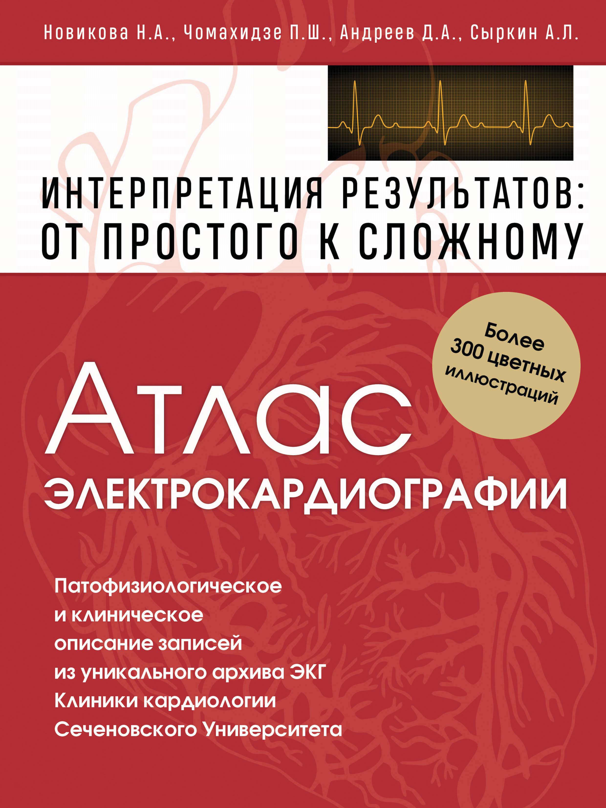 Атлас электрокардиографии. Интерпретация результатов: от простого к  сложному, Петр Чомахидзе – скачать pdf на ЛитРес