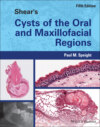 Shear\'s Cysts of the Oral and Maxillofacial Regions