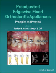 Preadjusted Edgewise Fixed Orthodontic Appliances