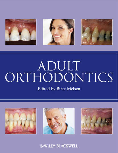Birte  Melsen - Adult Orthodontics