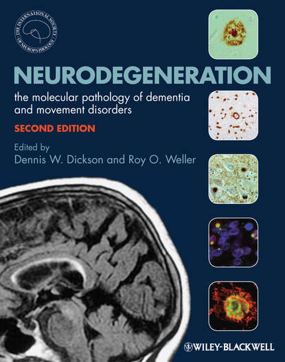 Neurodegeneration. The Molecular Pathology of Dementia and Movement Disorders