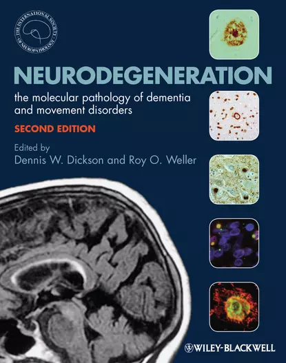 Обложка книги Neurodegeneration. The Molecular Pathology of Dementia and Movement Disorders, Weller Roy O.