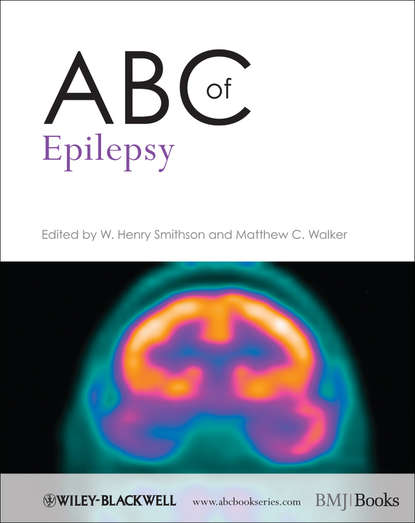 Smithson W. Henry - ABC of Epilepsy