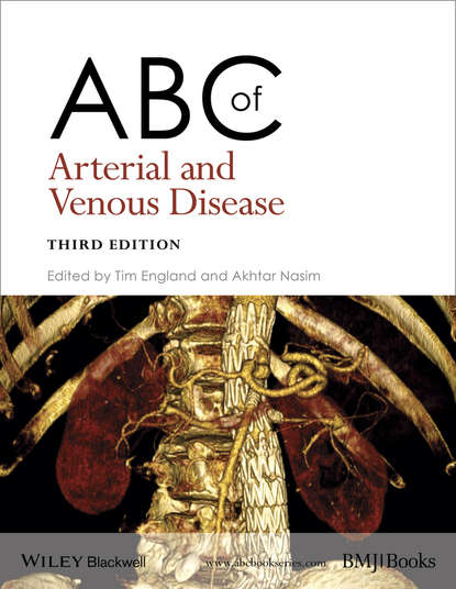 Nasim Akhtar - ABC of Arterial and Venous Disease