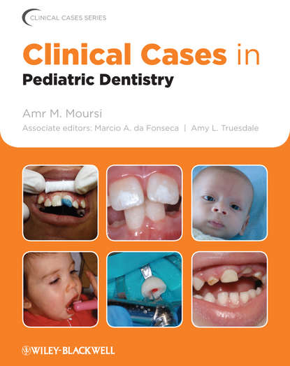 

Clinical Cases in Pediatric Dentistry