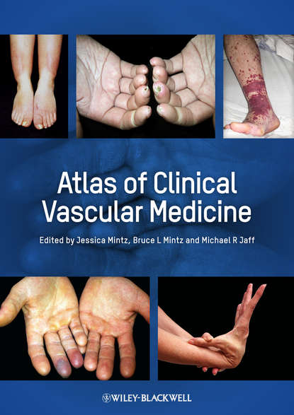 Atlas of Clinical Vascular Medicine - Группа авторов