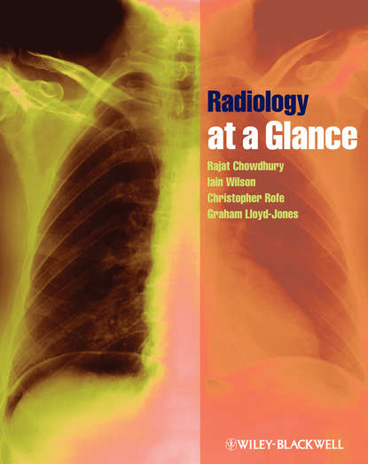 

Radiology at a Glance