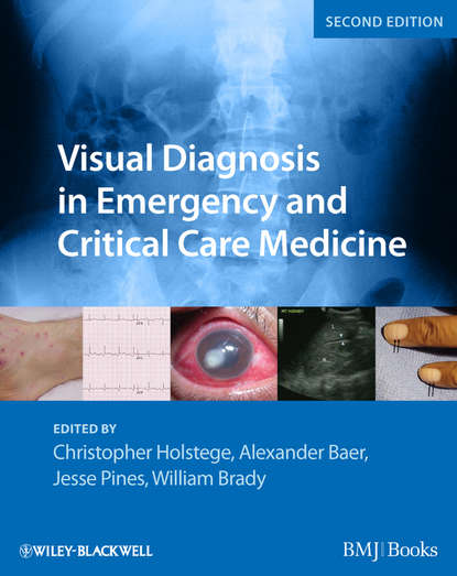 Visual Diagnosis in Emergency and Critical Care Medicine - William J. Brady