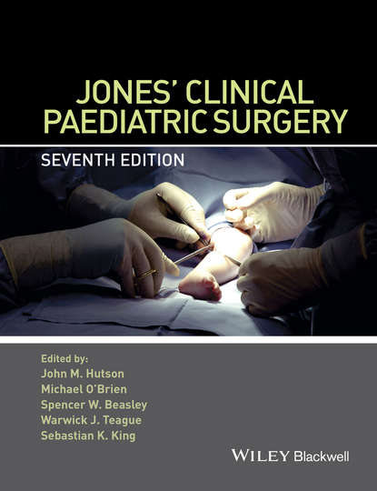 Jones Clinical Paediatric Surgery