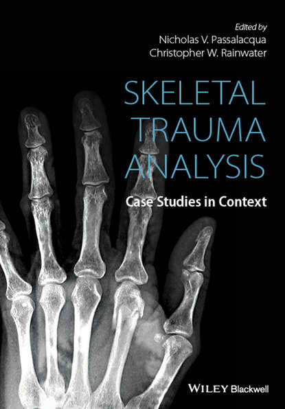 Skeletal Trauma Analysis - Группа авторов
