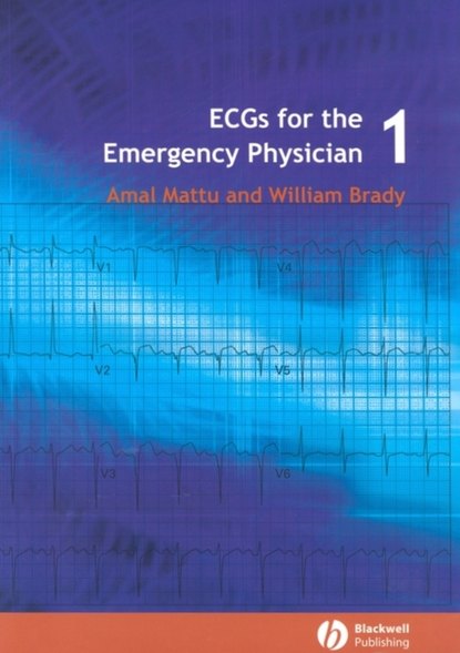 ECGs for the Emergency Physician 1 - Amal Mattu