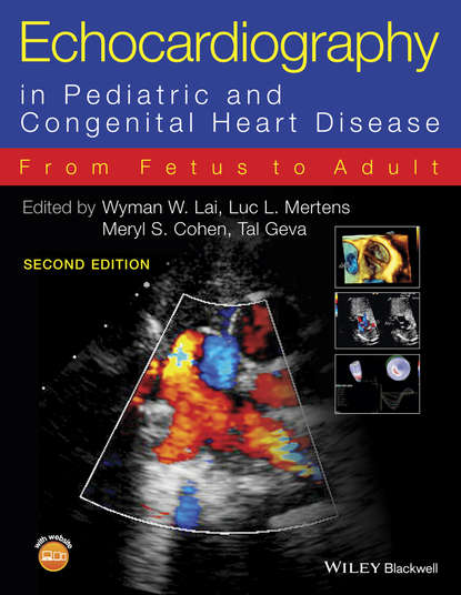 Echocardiography in Pediatric and Congenital Heart Disease - Wyman W. Lai