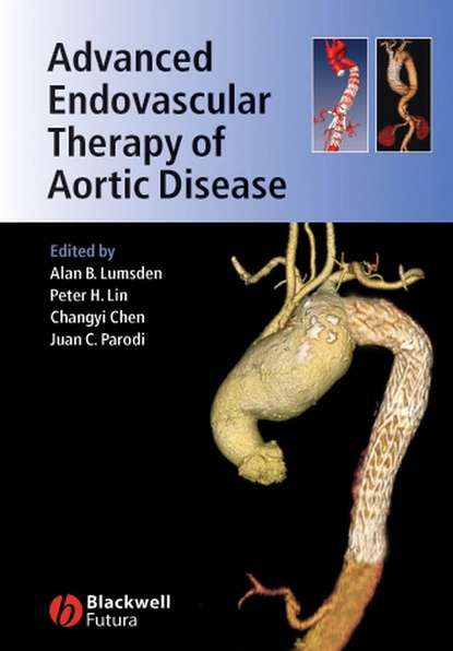 Changyi  Chen - Advanced Endovascular Therapy of Aortic Disease