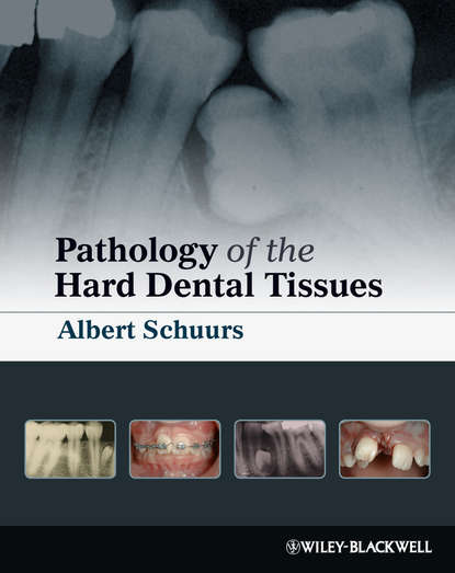 Pathology of the Hard Dental Tissues - Группа авторов