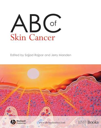 Sajjad  Rajpar - ABC of Skin Cancer