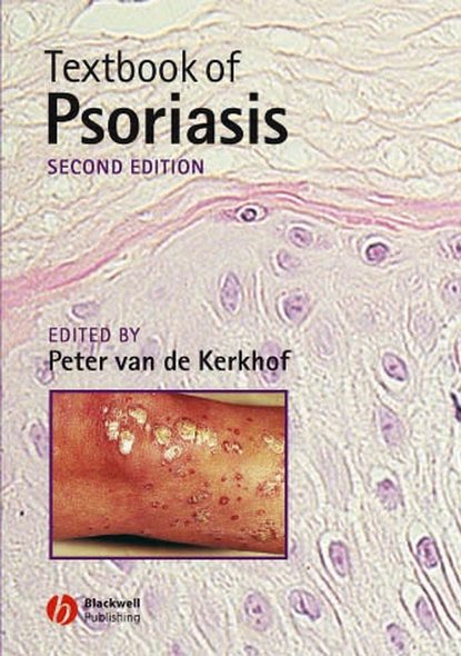 Textbook of Psoriasis - Peter C. M. van de Kerkhof