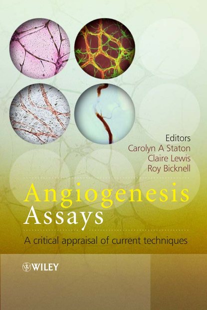 Claire  Lewis - Angiogenesis Assays
