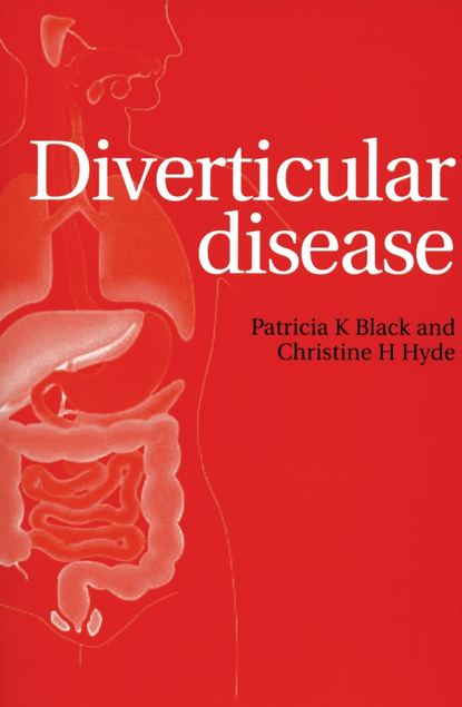 Pat  Black - Diverticular Disease