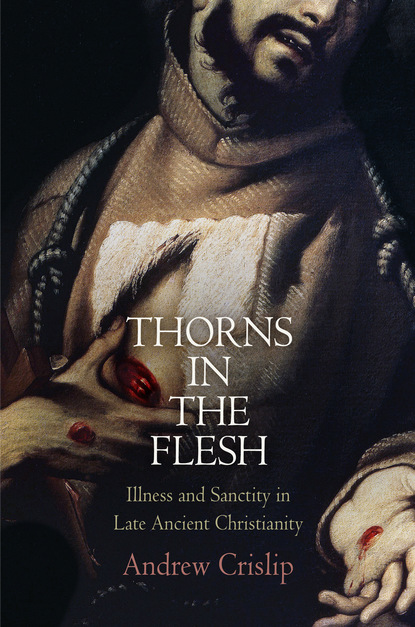

Thorns in the Flesh
