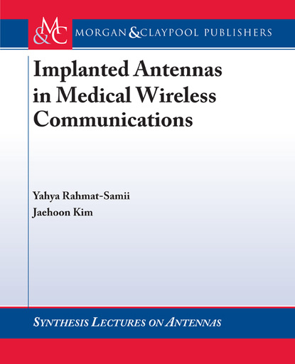 

Implanted Antennas in Medical Wireless Communications
