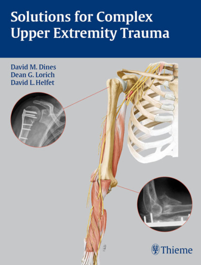 Группа авторов - Solutions for Complex Upper Extremity Trauma