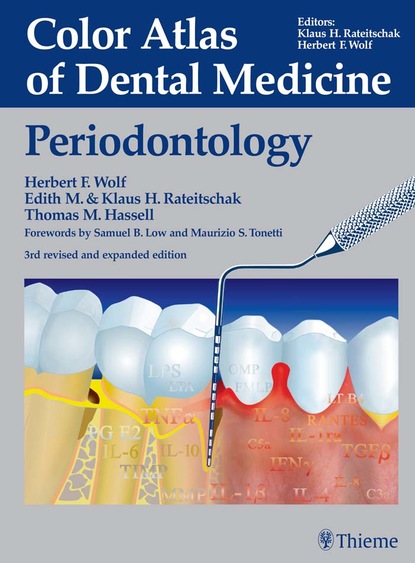 Herbert F. Wolf - Color Atlas of Dental Medicine: Periodontology