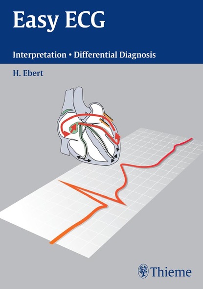 Hans-Holger Ebert - Easy ECG