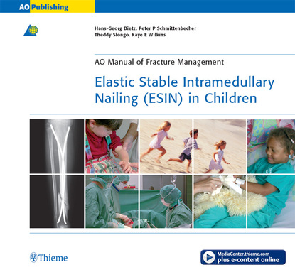 Hans-Georg Dietz - Elastic Stable Intramedullary Nailing (ESIN) in Children