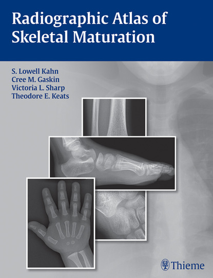 S. Lowell Kahn - Radiographic Atlas of Skeletal Maturation