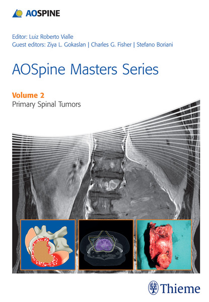 Luiz Roberto Gomes Vialle - AOSpine Masters Series Volume 2: Primary Spinal Tumors