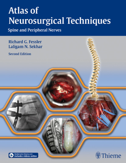 Группа авторов - Atlas of Neurosurgical Techniques