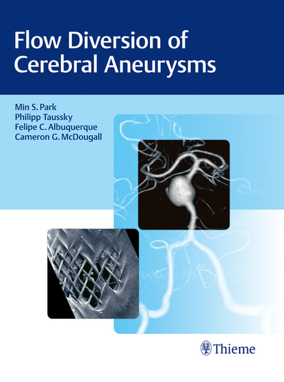 Felipe C. Albuquerque - Flow Diversion of Cerebral Aneurysms