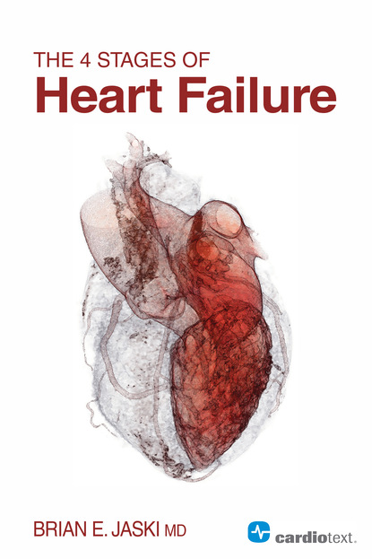 Brian Jaski - The 4 Stages of Heart Failure