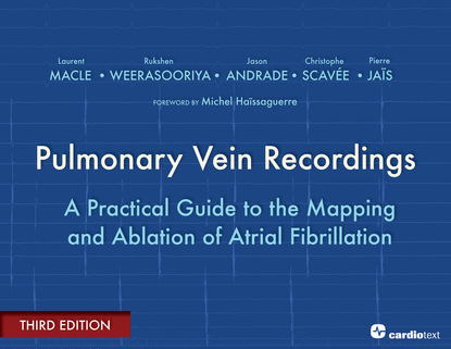 Laurent Macle - Pulmonary Vein Recordings : A Practical Guide to the Mapping and Ablation of Atrial Fibrillation Vol 3