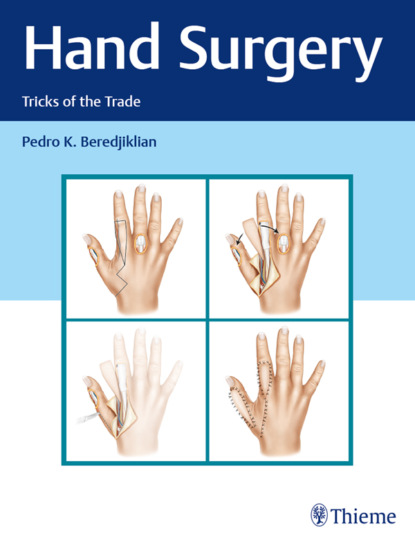 Pedro K. Beredjiklian - Hand Surgery