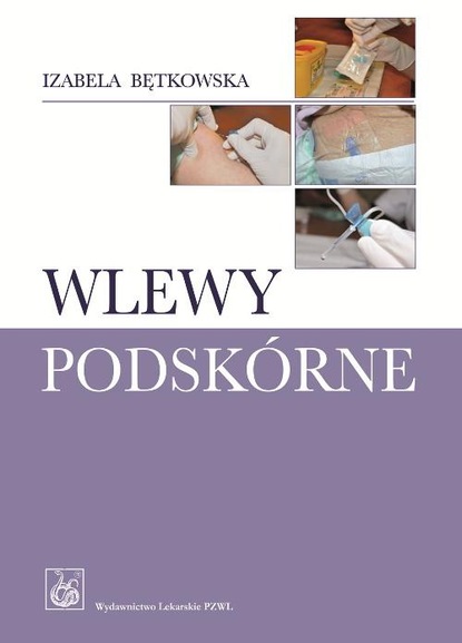 Izabela Bętkowska - Wlewy podskórne