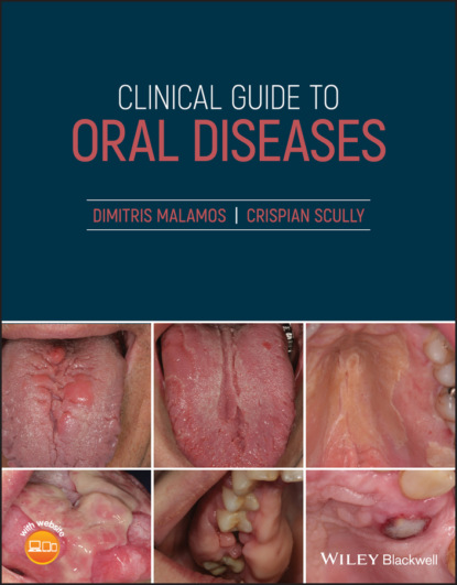 Crispian Scully — Clinical Guide to Oral Diseases