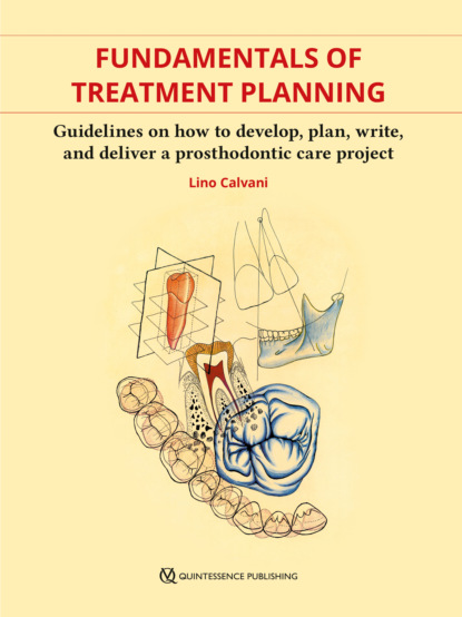 Lino Calvani - Fundamentals of Treatment Planning