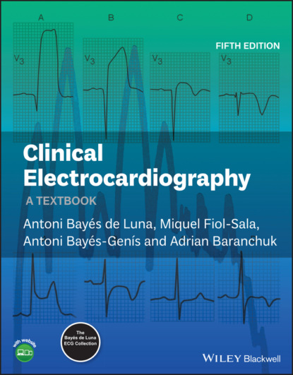 Clinical Electrocardiography - Miquel Fiol-Sala