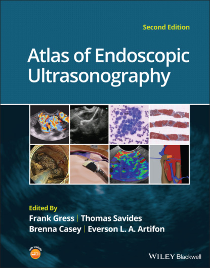 Atlas of Endoscopic Ultrasonography - Группа авторов