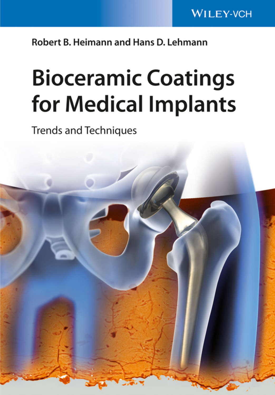Robert B. Heimann, Bioceramic Coatings for Medical Implants / Trends