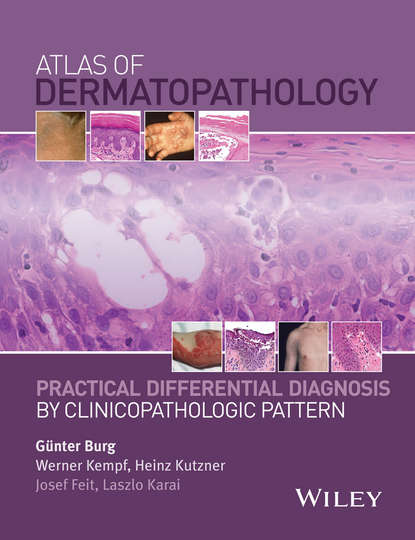 34444272-raznoe-5491582-atlas-of-dermatopathology-practical-differential-d-34444272.jpg